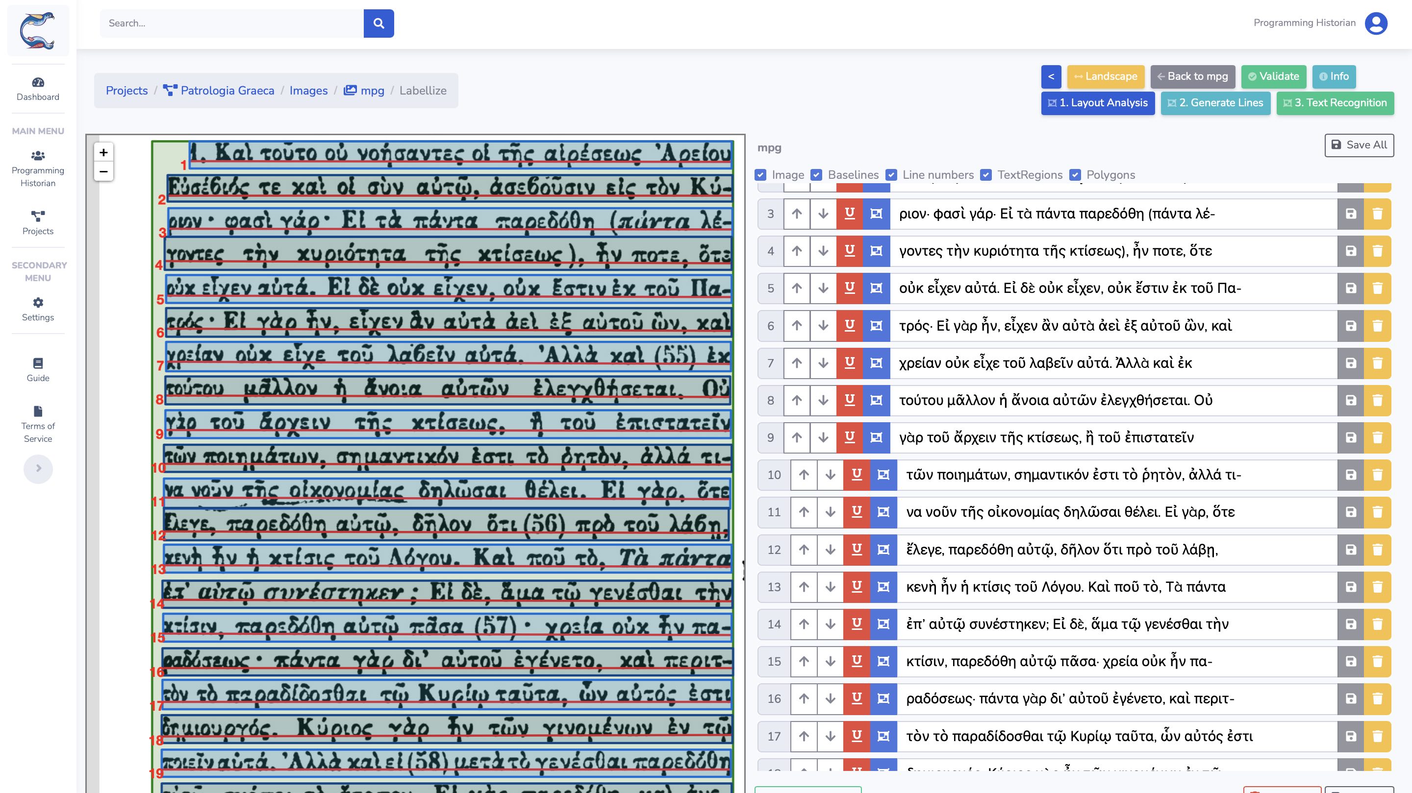 O interface de transcrição na Calfa Vision
